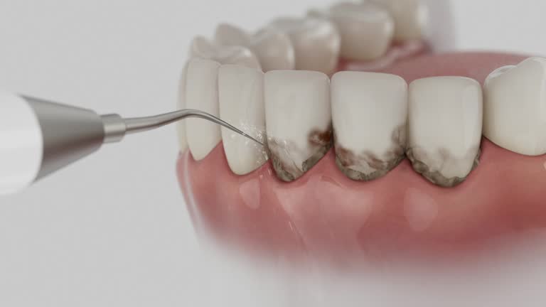 Trusted Tooth Extraction service in Barrett, TX - Dentist Open Now